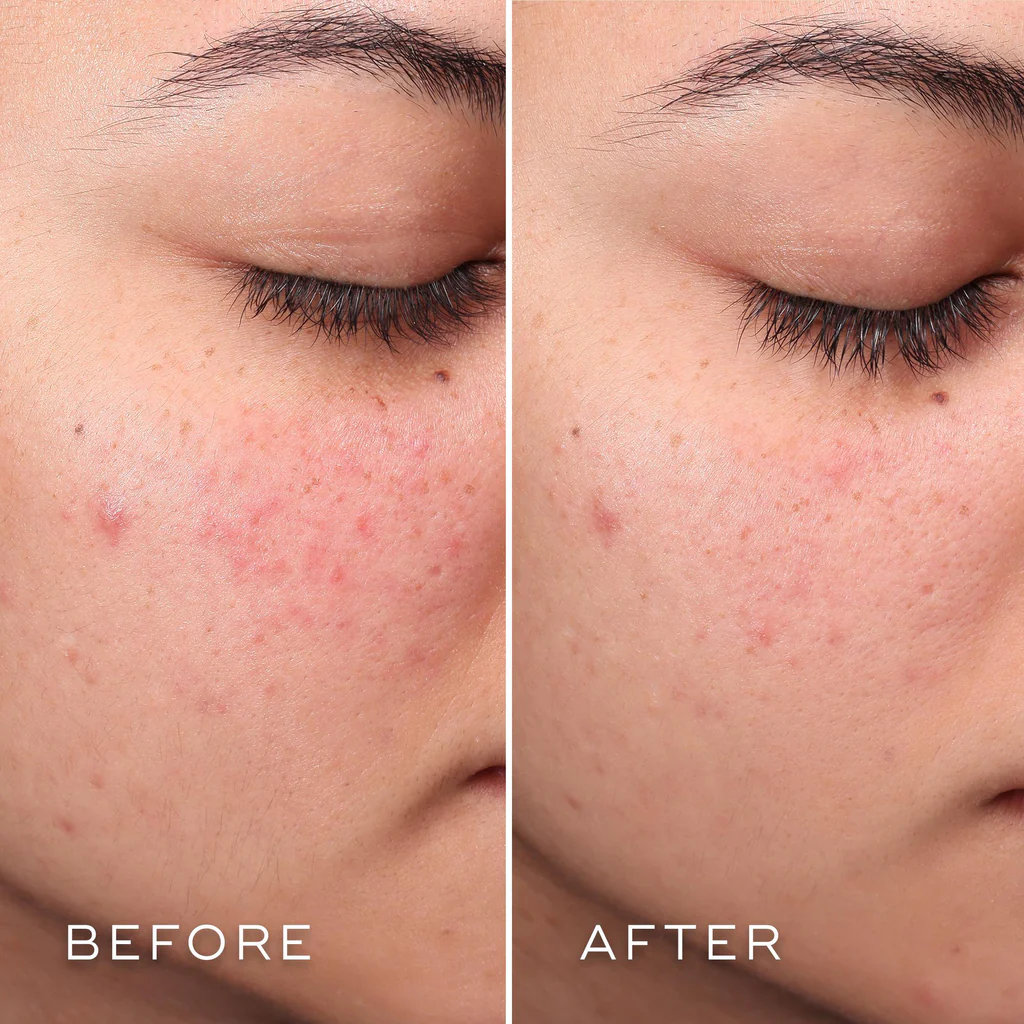 PRESS AND CLEAR REFILL - Imagen 2